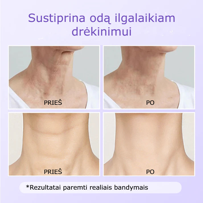Nerida – Peptidinis Kaklo Antiraukšlinis Pleistras