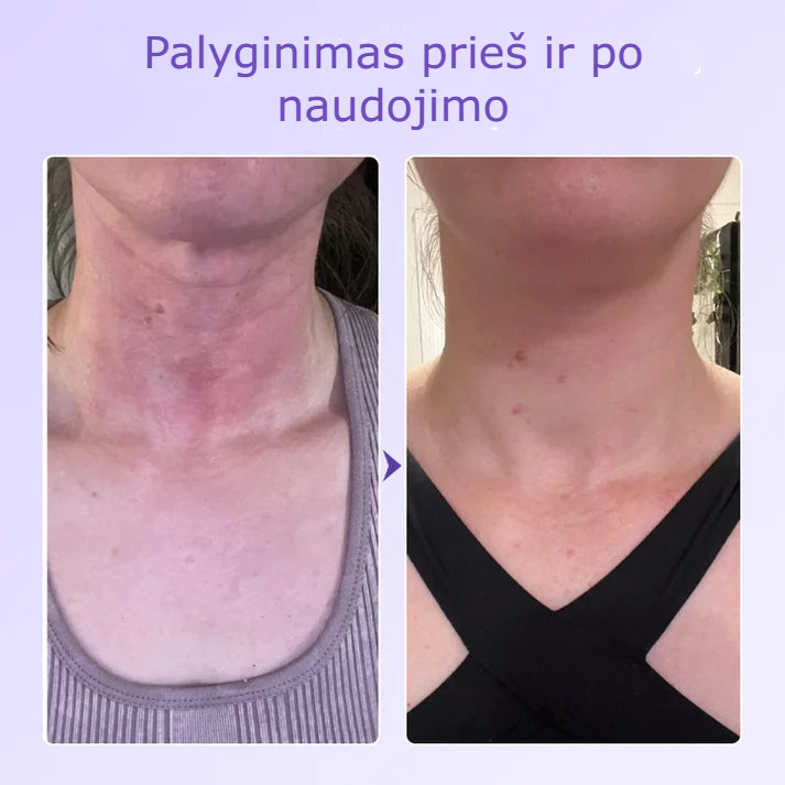 Nerida – Peptidinis Kaklo Antiraukšlinis Pleistras
