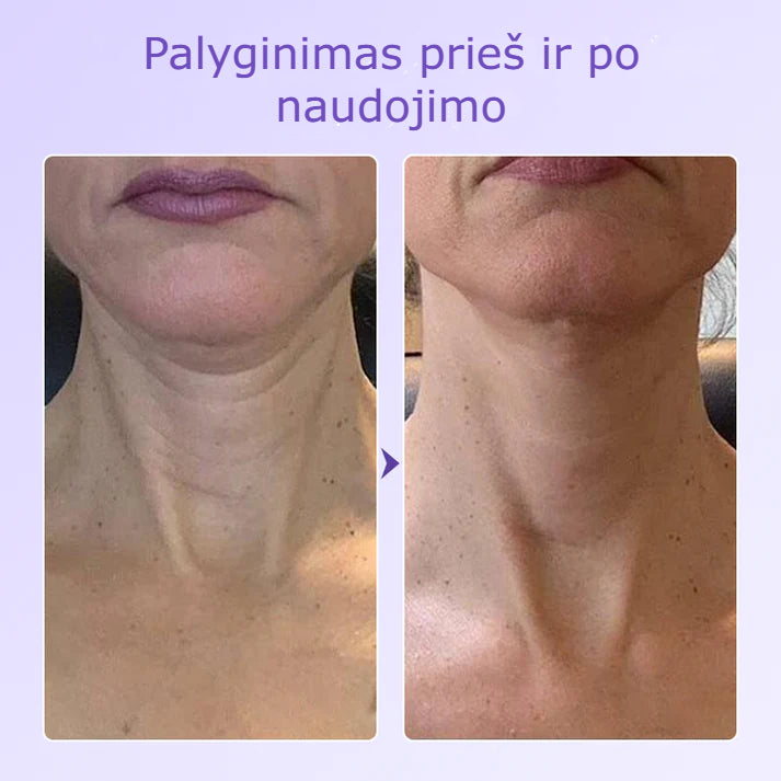 Nerida – Peptidinis Kaklo Antiraukšlinis Pleistras