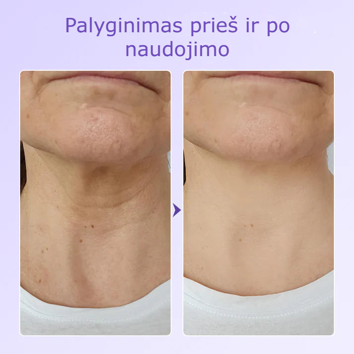 Nerida – Peptidinis Kaklo Antiraukšlinis Pleistras
