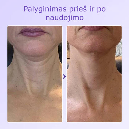 Nerida – Peptidinis Kaklo Antiraukšlinis Pleistras